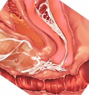 [Norn] 転生勇者と良妻魔王の子作りスローライフ_scu010e