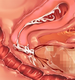 [Norn] 転生勇者と良妻魔王の子作りスローライフ_scu101b
