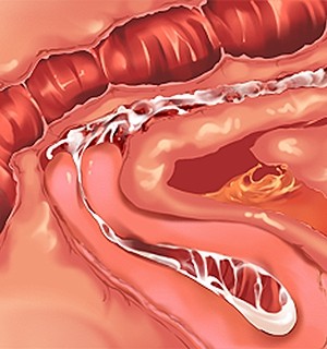 [Norn] 転生勇者と良妻魔王の子作りスローライフ_scu107c
