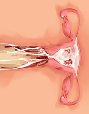 [Norn] 転生勇者と良妻魔王の子作りスローライフ_scu112e