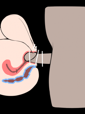 [ねこあらし (也な)] ふたなり、ってナニ？ [DL版]_155