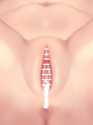 [NT00] 彼女は頭のネジが抜けてる完全版_095