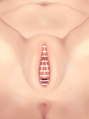 [NT00] 彼女は頭のネジが抜けてる完全版_087