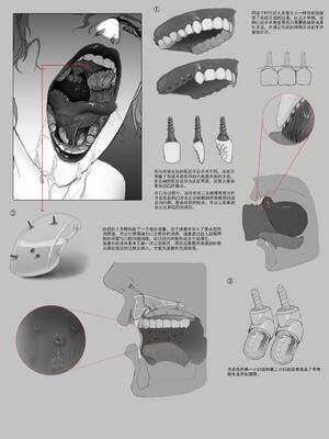 [JM]去重整合_103