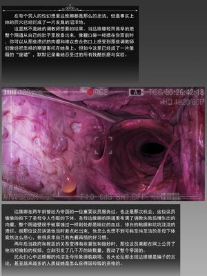 [JM]去重整合_148