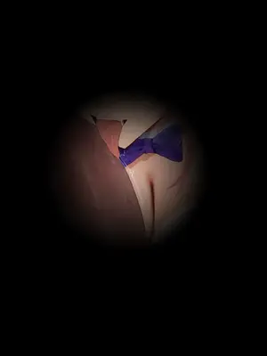 Moriaaa -八重神子[AI Generated]_315_277