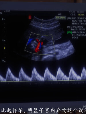 [敲西六]新乔安传4.2_045